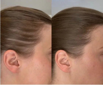 Fast Hair Growth Treatment