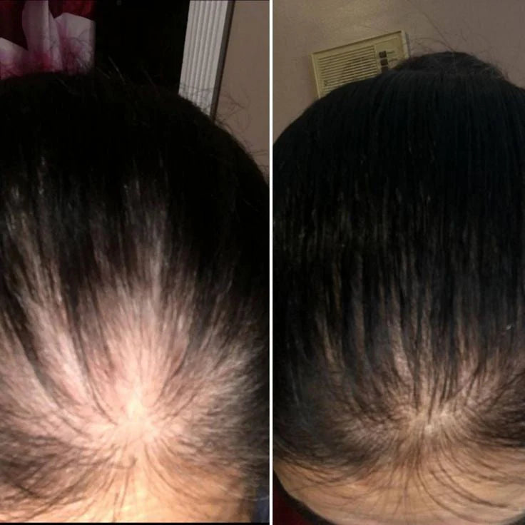 Fast Hair Growth Treatment